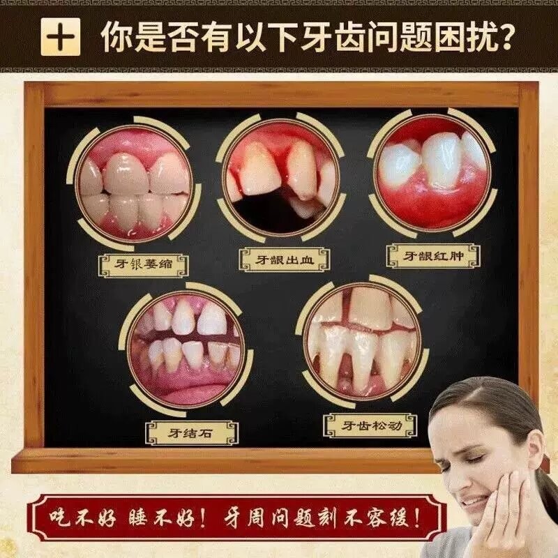 【Ready stock 】Specialized in the treatment of loose teeth. 专治牙齿松动防蛀牙膏