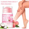 Crema Para Pies Con 60% De Urea Más 2% De