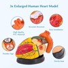 SFXYJ 3X Enlarged Anatomical Heart Model,3-Part Removable with Ventricles Atria