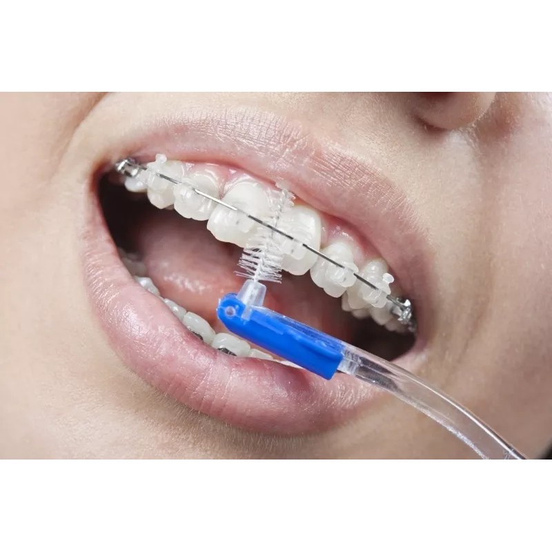 Borgatta Teens 10 Cepillos Dental Inter Ortho Teens Brackets Ortodoncia