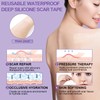 Cinta de silicona para cicatrices DMMYBJ – Reduce y previene