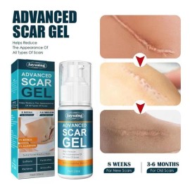 Crema For Eliminar Cicatrices Gel For Cicatrices De Acné &rb