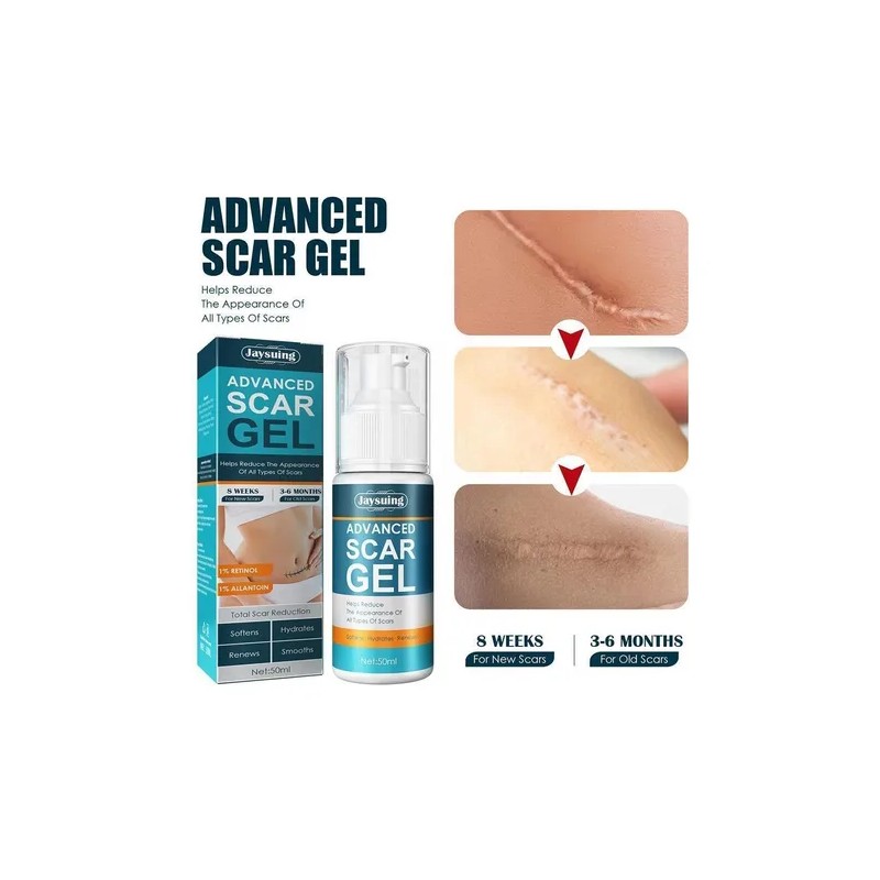 Crema For Eliminar Cicatrices Gel For Cicatrices De Acné &rb