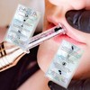Needleless Lip Filler Aftercare Card | 50 Pack | Business