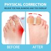 2 Stück Hallux Valgus Korrektur, Toe Separator, Überlappende Zehen korrektur,