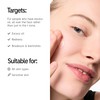 The INKEY List Serum with 20% Niacinamide, 30 ml, Supersolutions
