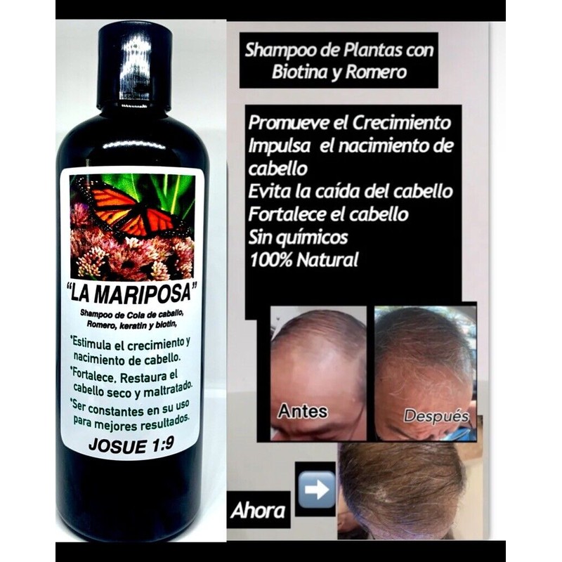 Shampoo De Cola De Caballo, Romero Aloe Vera Crecimiento De