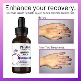 PlumDragon Dit Da Jow Bruise Juice, Whole Herb - 2 Oz