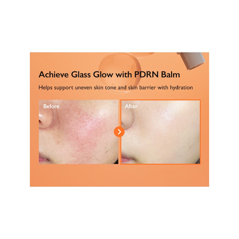 Genabelle [Genabelle]PDRN Enriched Recovery Balm 50ml