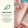 Plant Therapy KidSafe Itch Away Essential Oil Blend Pre-Diluted Roll-On