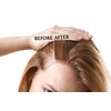 KHENZ SHAMPOO INVIGORATING Regenerating Hair Removal Hair Cells 250 ml