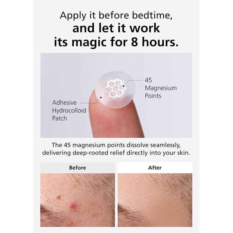 DWEasyDerm EasyDerm Micro Point Acne Patch Duo – 10 Magnesium