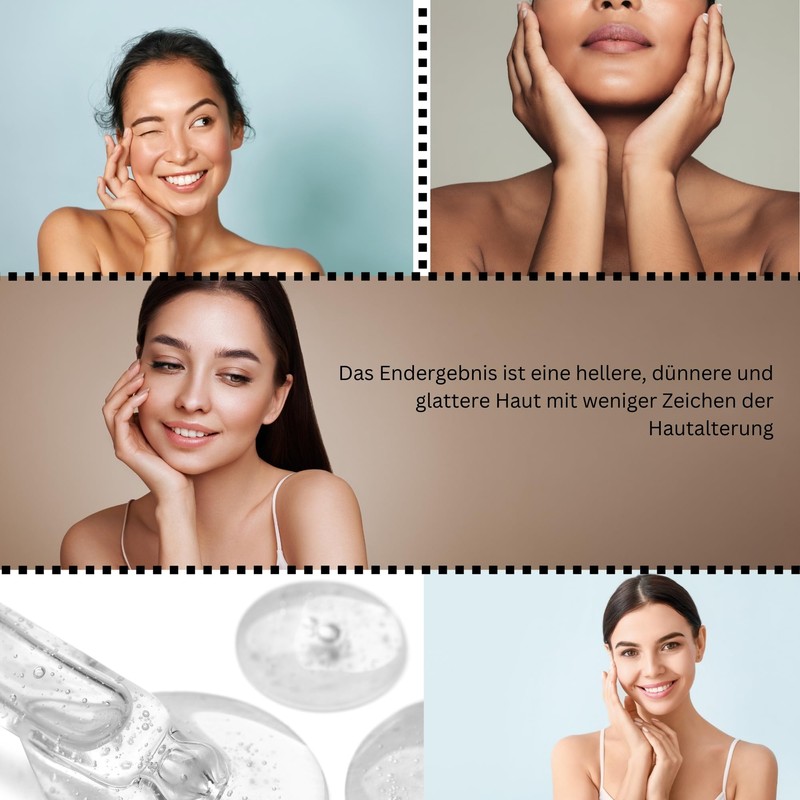 Glycolic Acid Exfoliation, Anti-Blemish and Acne Treatment, Smooth, Luminous Skin,