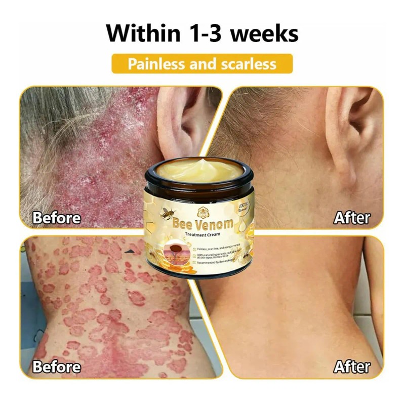 Crema Natural Para El Cutis Con Forma De Abeja |