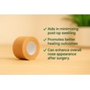 Micropore Surgical Tape Tan 2.5cm x 9.1m – Pack of