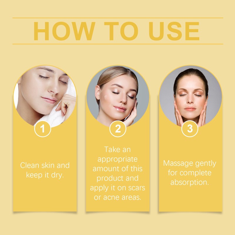 Facial Acne Care Gel (2)