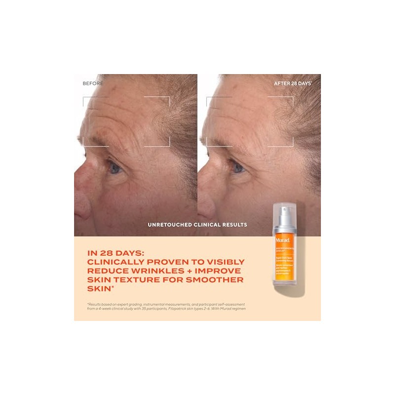 Murad Rapid Dark Spot Correcting Serum - Environmental Shield -