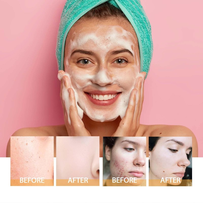 Turmeric Foaming Face Wash, Deep Cleansing Exfoliating Glow Wash Turmeric