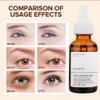AFCRYIYE New Caffeine Solution 5%+ EGCG, Facial Caffeine Eye Serum,