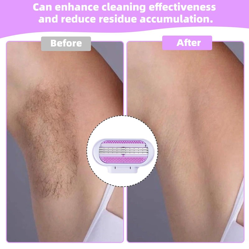 10PCS Venus Razors for Women Refill, Replacement Venus Razor Blades