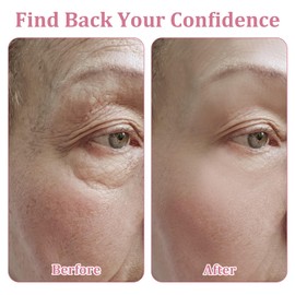 Pack of 192 Anti-Wrinkle Plasters, Anti Wrinkle Patches, Wrinkle Patches, Facial Patches, Reusable for Smoothing Eyes, Mouth or Face