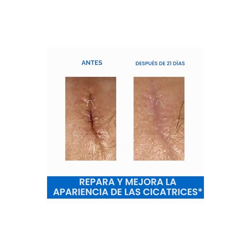 Uriage Bariederm-Cica Crema Reparadora