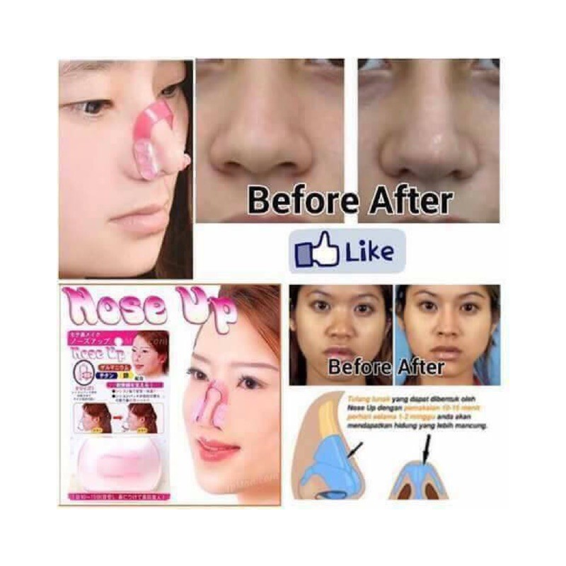 Nose Up Plastic Lifting Shaping Clipper
