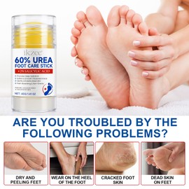 Urea Cream 60 Percent for Feet Plus 2% Salicylic Acid, Urea Foot Cream for Cracked Heels and Dry Skin, Cracked Heel Repair Cream, 2PCS