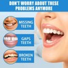 UAYSUING Shapeable Denture Pellets - Mouldable False Teeth Solution for