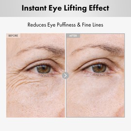 NATUREKIND NATUREKIND Hyaluron Lifting Eye Cream, Hyaluronic Acid, 5% Arbutin, Niacinamide for Puffy Eyes and Fine Lines, Korean Skin Care, Hydrating Under Eye Cream, 15ml, 0.5 fl. oz.