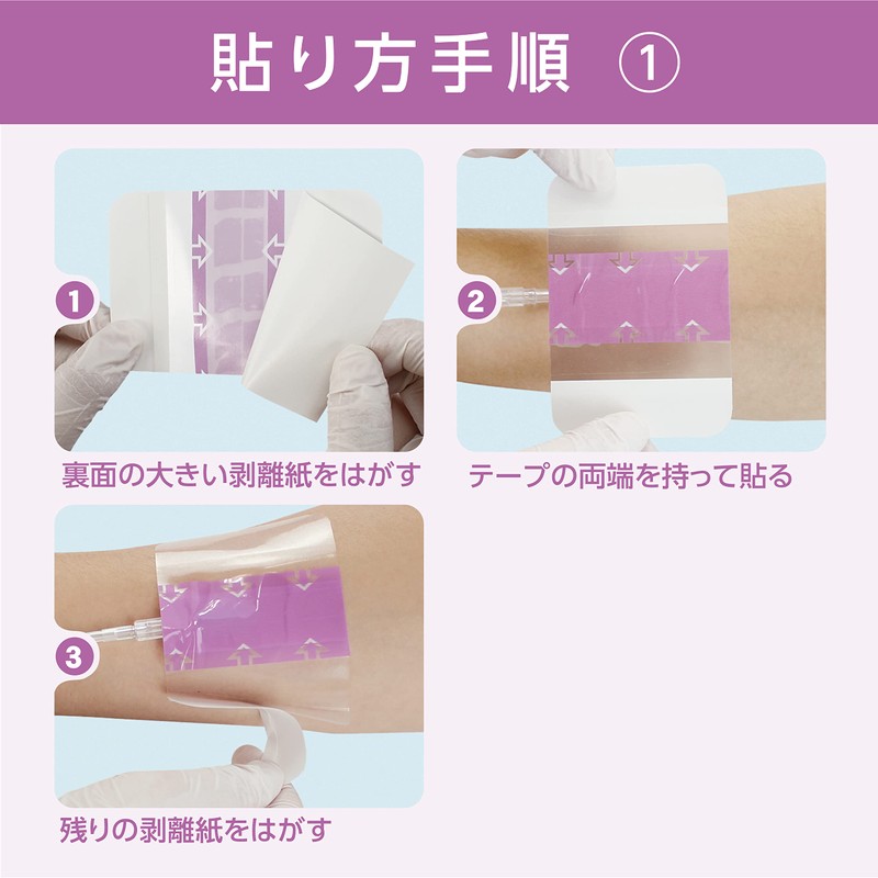 ミリオンエイド フィルフィックス20 60×70mm 100枚 フィルムドレッシング 滅菌 個包装 防水 YB-256070