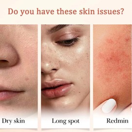 Powerful Anti-Aging Solution with Vitamin C & Brightening - Targets Dark Spots, Smooths Skin & Yields Optimal Results with Gentle Formula