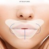 Correction patch for night mouth when mouth is open to