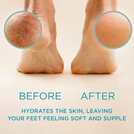 Lee Beauty Professional Callus Remover for Feet - Original Formula with Extra Strength Gel - 8 Oz for Cracked & Dead Dry Skin Supplies Hydrating Kit Nails Skincare - Scent: 3 Piece Set, Style: Foot File + Gel