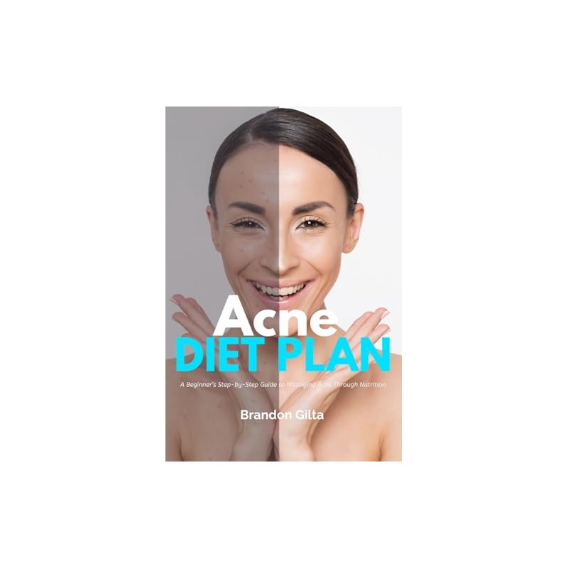 Acne Diet Plan: A Beginner's Step-by-Step Guide to Managing Acne