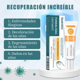 Pomada Antifúngica Para Uñas,tratamiento Contra Hongos 30g