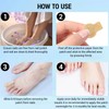 Xumann 8 Hours Fungal Nail Patches, 21 Pcs Multi Purpose
