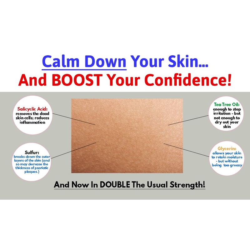 V Series Creams V66 MAX C DOUBLE STRENGTH Psoriasis Treatment