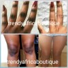 TRENDY Glitzluxury Double Action Knuckles, Elbows, Knees, Armpit Cream👌50ml X1.