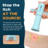 YARKOR Bug Bite Suction Tool, Natural Itch & Swelling Reduction,