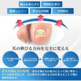 巻き爪器具 2個入り 巻き爪 まきづめ 陥入爪 まきずめ 巻爪 器具 オリジナル説明書付属 (21-23mm)