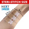 NEXT LEVEL MED Steri-Stitch Wounds & Cuts Closure Kit -