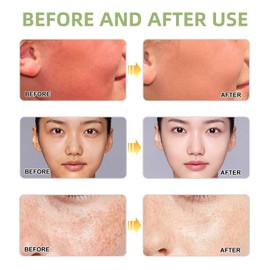 Centella Sun Cream SPF 50 Pa+++,Centella Sunscreen,Water-Fit Sun Serum,Soothing S/un Cream SPF 50+,Daily Hydrating S/un Lotion,SPF50 Face Moisturiser,Lightweight Spf50+,Broad Spectrum UV Protection