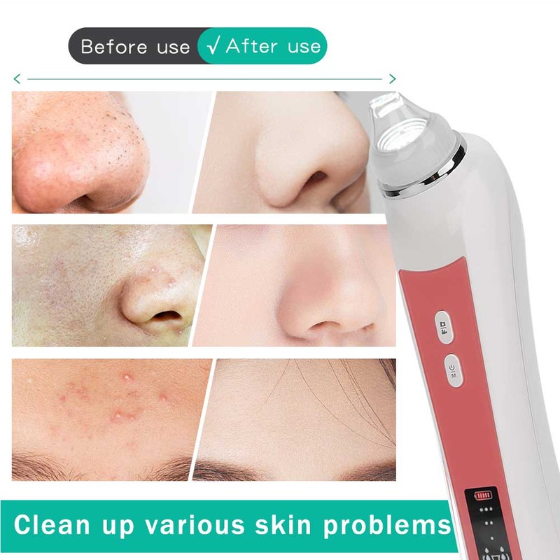 Electric Facial Blackhead Cleansing Vacuum Suction Machine with 20X 5MP