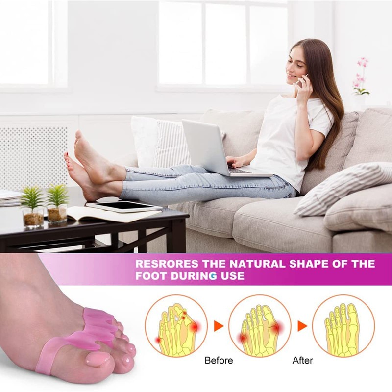 Toe Spacers(2 Pair), Gel Toe Separators to Correct Toes, Bunion