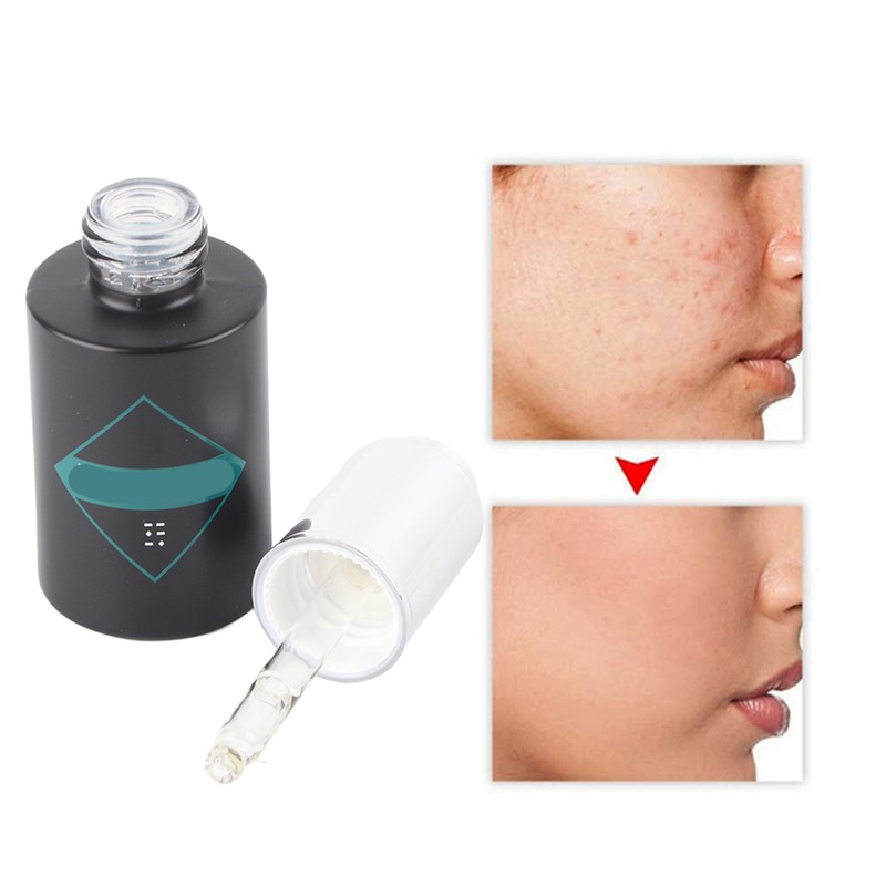 Skin Brightening Moisturizing Oligopeptide Serum Fade Acne Marks Repair Face