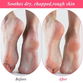 15Pairs Moisturizing Socks Overnight, Cotton Moisture Enhancing Socks, Spa Sock for Cracked Heel Repair, Spa Moisturizing Sock for Women and Men, White