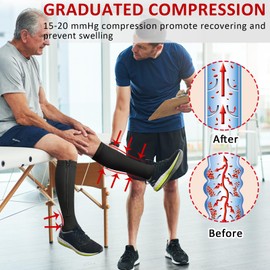 Ailaka Zipper 15-20 mmHg Compression Socks for Women Men, Knee High Open Toe Support Graduated Medical Varicose Veins Hosiery for Edema, Swollen, Pregnancy, Recovery (1 Pair)