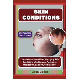 SKIN CONDITIONS: Like Psoriasis and Eczema: Comprehensive Guide to Managing Skin Conditions with Skincare Regimens, Medication, and Symptom Control