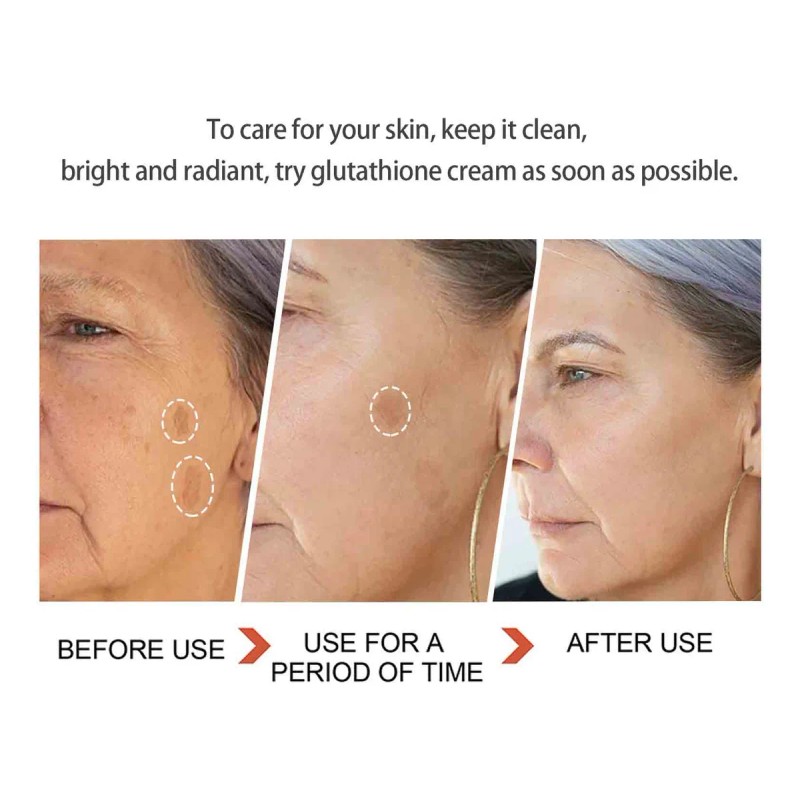 Crema Rejuvenecedora Y Rejuvenecedora Para Ojos V, Hidratant
